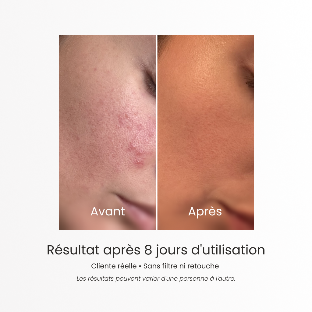 Savon solide purifiant