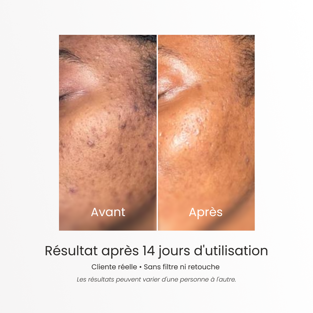 Routine Skincare