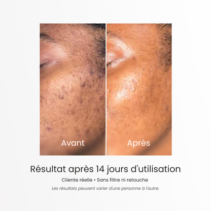 Routine Skincare