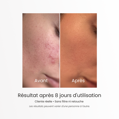 Savon solide purifiant